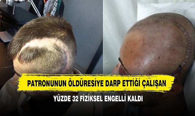 Patronunun Öldüresiye Darp Ettiği Çalışan Yüzde 32 Fiziksel Engelli Kaldı