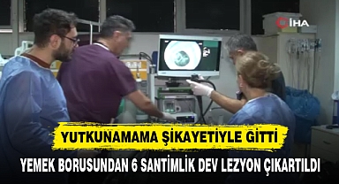 YEMEK BORUSUNDAN 6 SANTİMLİK DEV LEZYON ÇIKARTILDI