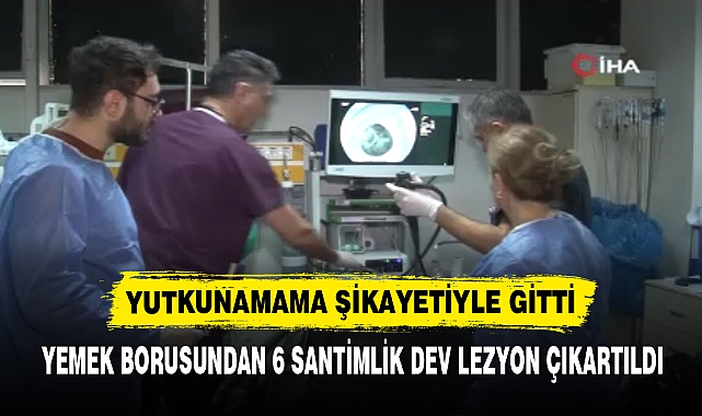 YEMEK BORUSUNDAN 6 SANTİMLİK DEV LEZYON ÇIKARTILDI