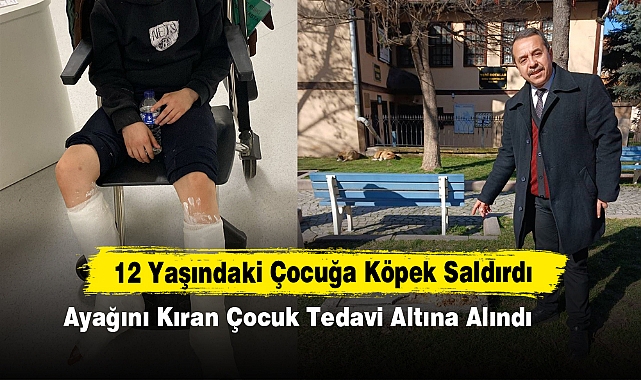 12 Yaşındaki Çocuğa Köpek Saldırdı