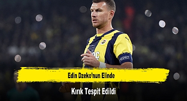 Edin Dzeko’nun Elinde Kırık Tespit Edildi