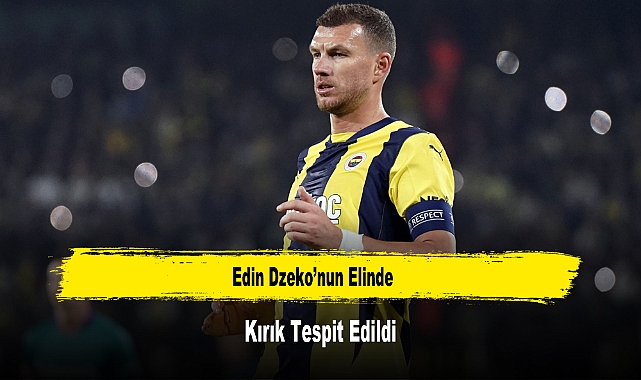 Edin Dzeko’nun Elinde Kırık Tespit Edildi