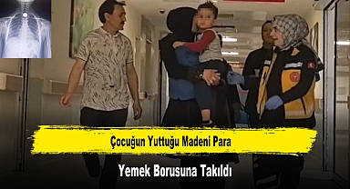 Çocuğun Yuttuğu Madeni Para Yemek Borusuna Takıldı