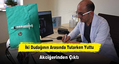 İki Dudağının Arasında Tutarken Yuttu, Akciğerinden Çıktı