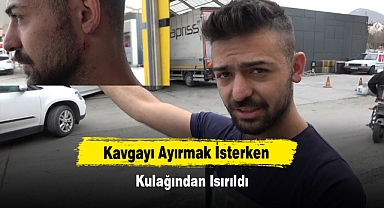 Kavgayı Ayırmak İsterken Kulağından Isırıldı