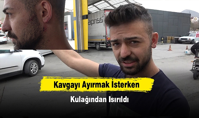 Kavgayı Ayırmak İsterken Kulağından Isırıldı