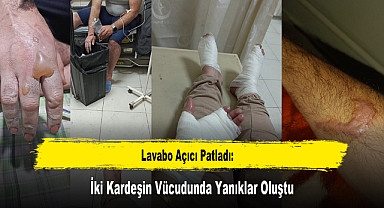 Lavabo Açıcı Patladı: İki Kardeşin Vücudunda Yanıklar Oluştu