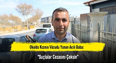 Okulda Kızının Vücudu Yanan Acılı Baba: