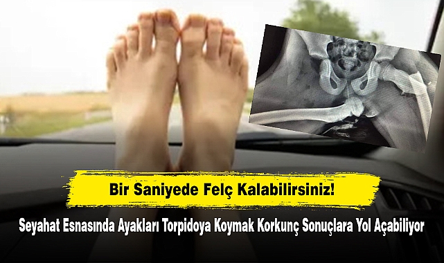 Bir Saniyede Felç Kalabilirsiniz!  Seyahat Esnasında Ayakları Torpidoya Koymak Korkunç Sonuçlara Yol Açabiliyor