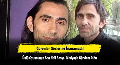 Görenler Gözlerine İnanamadı! Ünlü Oyuncunun Son Hali Sosyal Medyada Gündem Oldu