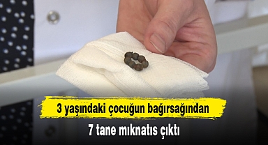 3 yaşındaki çocuğun bağırsağından 7 tane mıknatıs çıktı