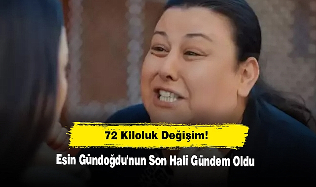 72 kiloluk değişim! Esin Gündoğdu'nun Son Hali Gündem Oldu