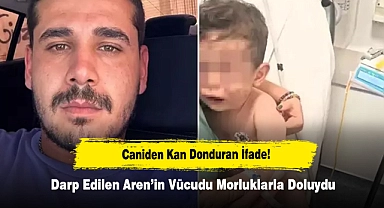 Caniden Kan Donduran İfade!  Darp Edilen Aren’in Vücudu Morluklarla Doluydu