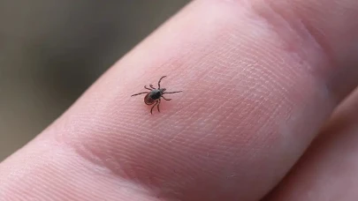 Keneyi Kendi Çıkaran 65 Yaşındaki Adam Hayatını Kaybetti