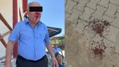 Başkan Güllü'ye Yumruklu Saldırı!