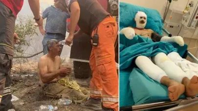 Yanıyorum, Su Verin" Diye Feryat Etmişti… Eşi, Kahraman Orman İşçisinin Son Halini Paylaştı