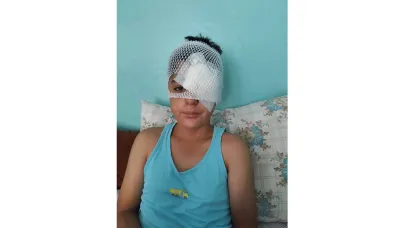 Köpek Saldırısından Kaçan Çocuğa Otomobil Çarptı