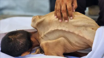Gazze'de günden güne eriyen Adil, açlıktan ölmeden önce 15 kiloya düştü