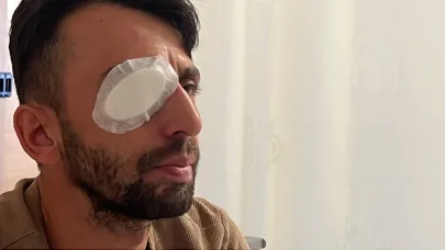 Belediye İşçisi Kör Kurşunun Mağduru Oldu