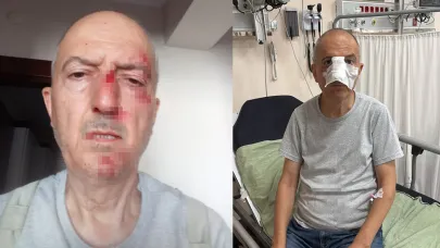 Boşanma Davası Kabusa Döndü: Evi Satılan Adam, Kayınbiraderi Tarafından Darp Edildi