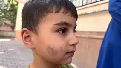 Lağım Faresi Uyuyan Çocuğu Isırdı