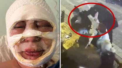 Kadıköy’de Kan Donduran Vahşet: Mekanda Otururken Ateşe Verildi- Talihsiz Kadın O Anları Anlattı!