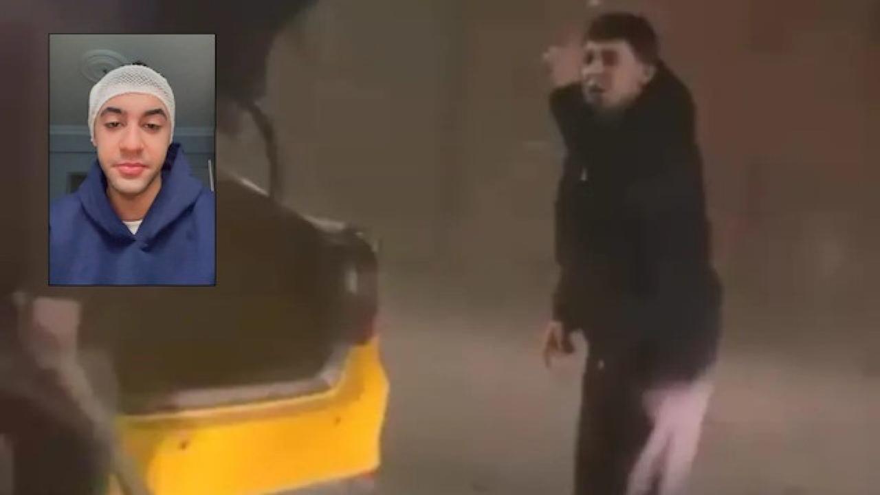 Taksici trafikte tartıştığı motosikletliyi sopayla yaraladı: Başına 6 dikiş atıldı