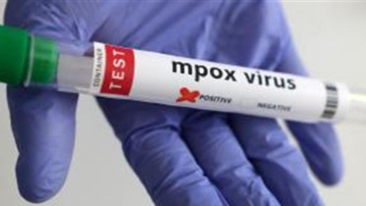 Maymun Çiçeği Virüsünün Yeni Bir Türü Belirlendi