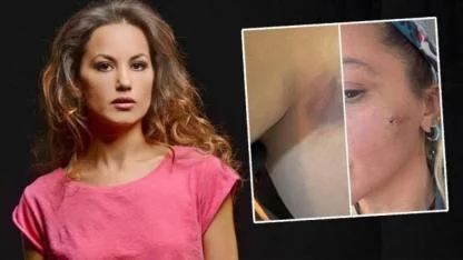 Yıldız Asyalı Eşinden Şiddet Gördüğünü Açıklamıştı:Mustafa Semih Demirci'den Yanıt Gecikmedi!