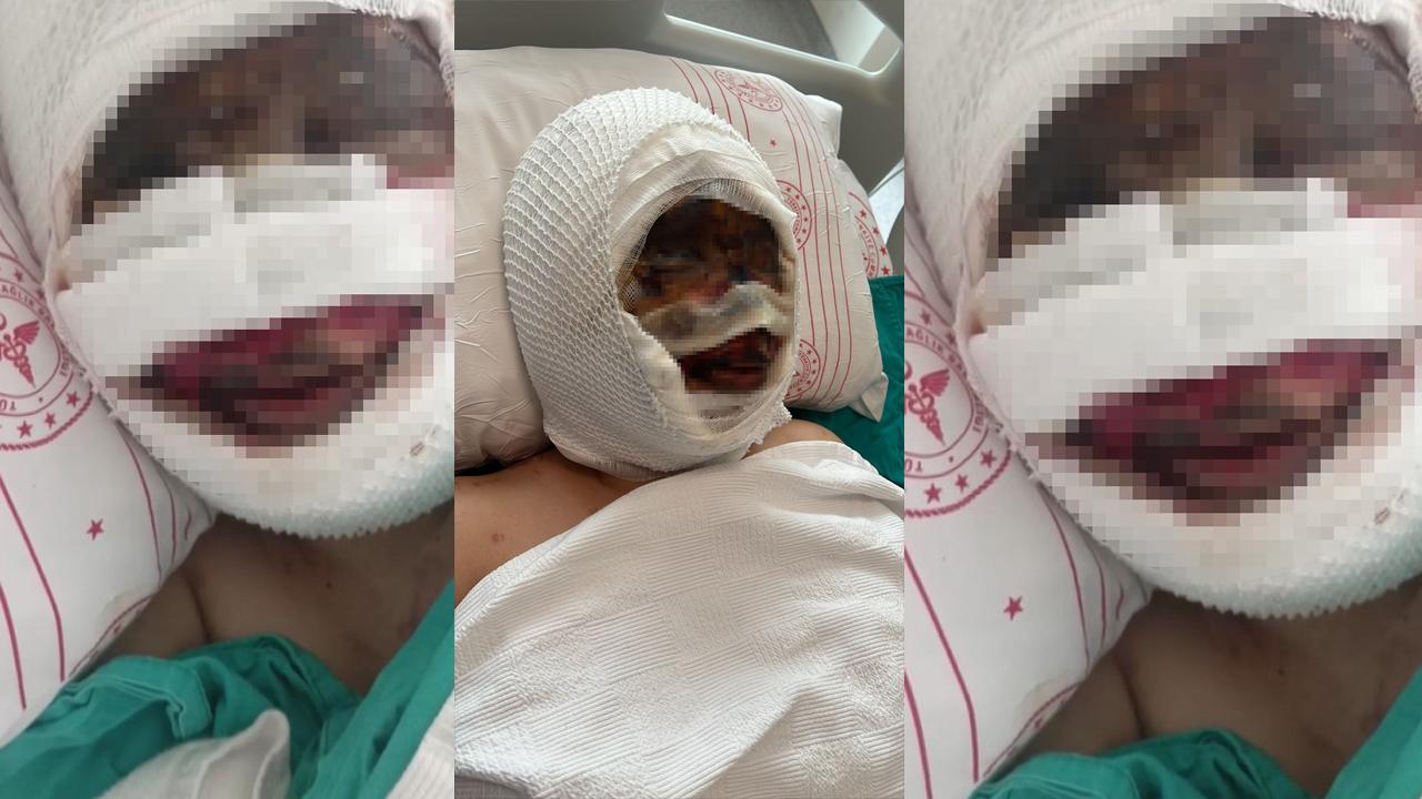 Eski Eşi Tarafından Vahşete Uğrayan Kadın O Anları Anlattı