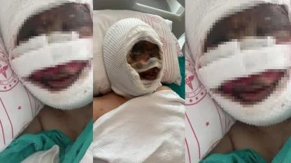 Eski Eşi Tarafından Vahşete Uğrayan Kadın O Anları Anlattı