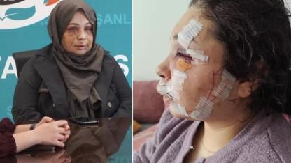 Eşine Şiddet Uygulayan Cumhurbaşkanı Koruma Dairesi Personeli Tutuklandı