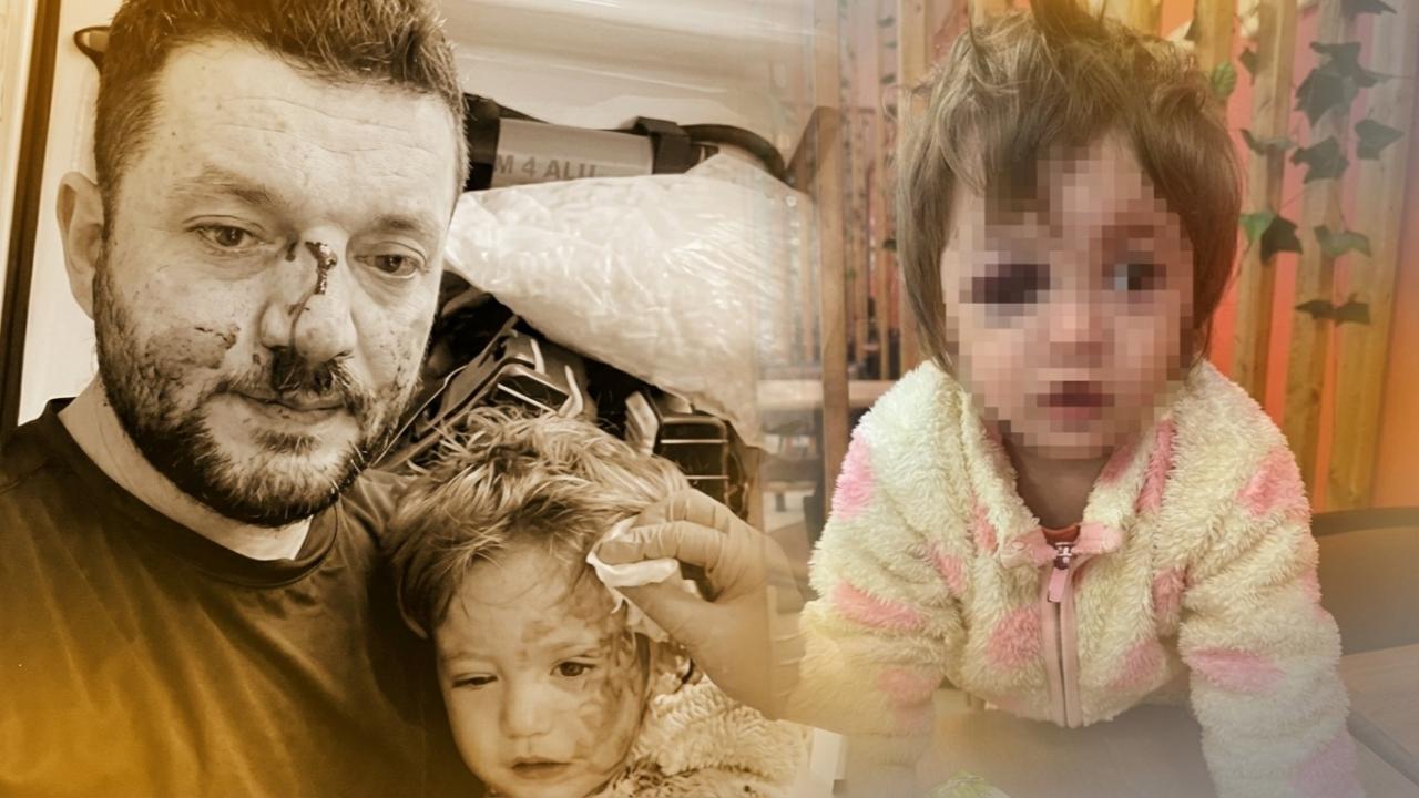 14 Aylık Bebek Ve Babasına Saldırı! Bakanlık Harekete Geçti