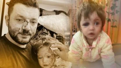 14 Aylık Bebek Ve Babasına Saldırı! Bakanlık Harekete Geçti
