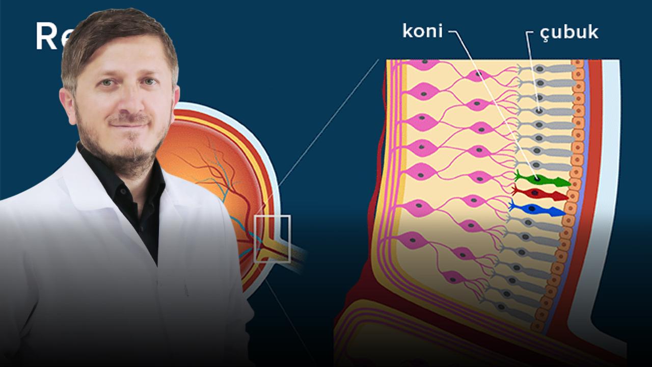“Anı Işık Çakması Ve Uçuşmalar Retina Yırtığının Habercisi Olabilir”