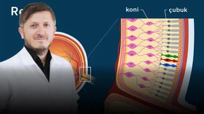 “Anı Işık Çakması Ve Uçuşmalar Retina Yırtığının Habercisi Olabilir”