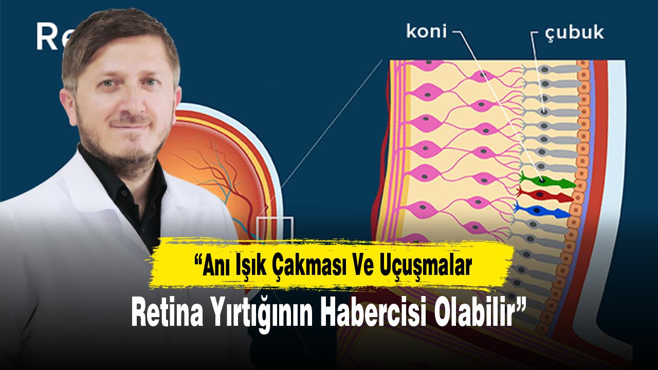 “Anı Işık Çakması Ve Uçuşmalar Retina Yırtığının Habercisi Olabilir”