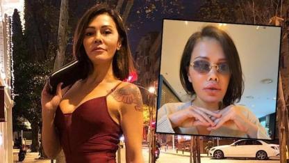 Eski Survivor Yarışmacısı Didem Ceran Yüz Nakliyle Tanınmaz Hale Geldi!