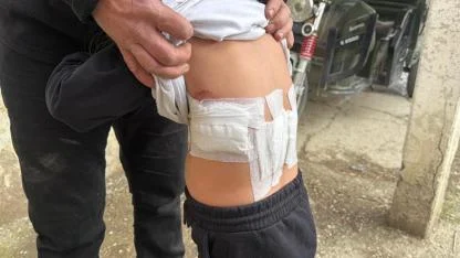 Afyon’da Şoke Eden Olay! 5 Yaşındaki Çocuğa Eşek Saldırısı