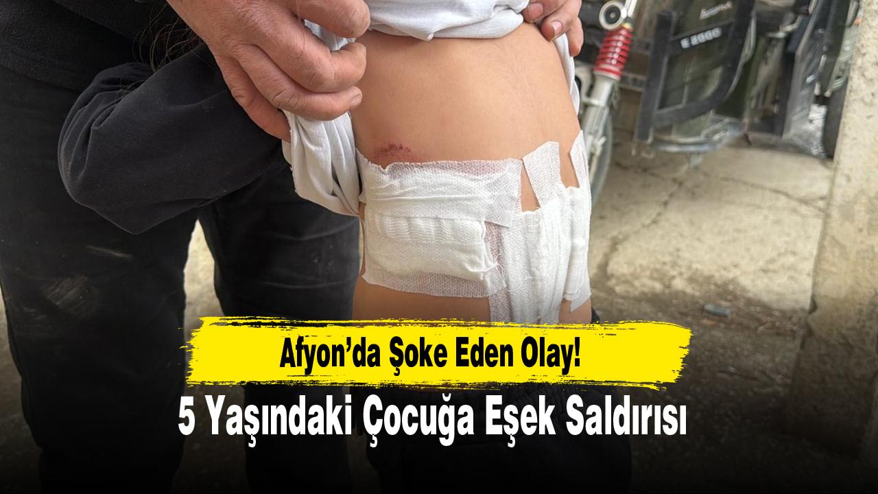 Afyon’da Şoke Eden Olay! 5 Yaşındaki Çocuğa Eşek Saldırısı