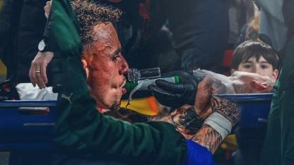 Noa Lang'ın parmağı kopmuştu! UEFA ve Liverpool'dan olayla ilgili karar