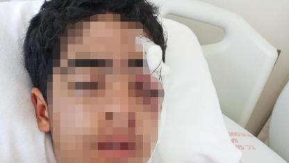 Esenyurt’ta Kan Donduran Saldırı: 15 Yaşındaki Çocuk Muştayla Ağır Yaralandı