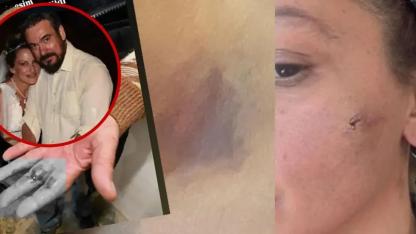 Oyuncu Yıldız Asyalı’dan Yardım Çağrısı: "Can Güvenliğimiz Yok"