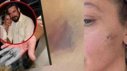 Oyuncu Yıldız Asyalı’dan Yardım Çağrısı: "Can Güvenliğimiz Yok"