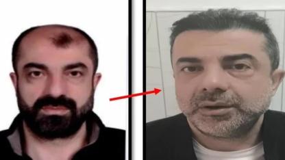 Estetikle yüzünü değiştirip kardeşinin kimliğiyle Türkiye’ye girdi: 7 yıl sonra yakalandı