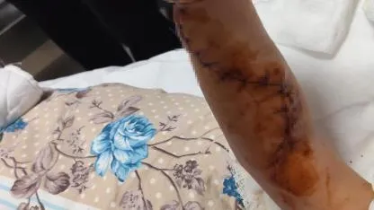 Tomografiye giren 1,5 yaşındaki çocuğun başına neler geldi neler?