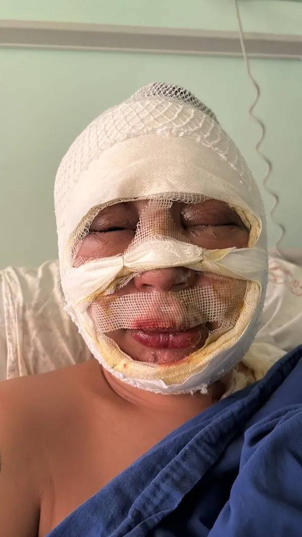 Kadıköy’de Kan Donduran Vahşet: Mekanda Otururken Ateşe Verildi- Talihsiz Kadın O Anları Anlattı!