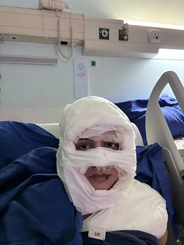 Kadıköy’de Kan Donduran Vahşet: Mekanda Otururken Ateşe Verildi- Talihsiz Kadın O Anları Anlattı!