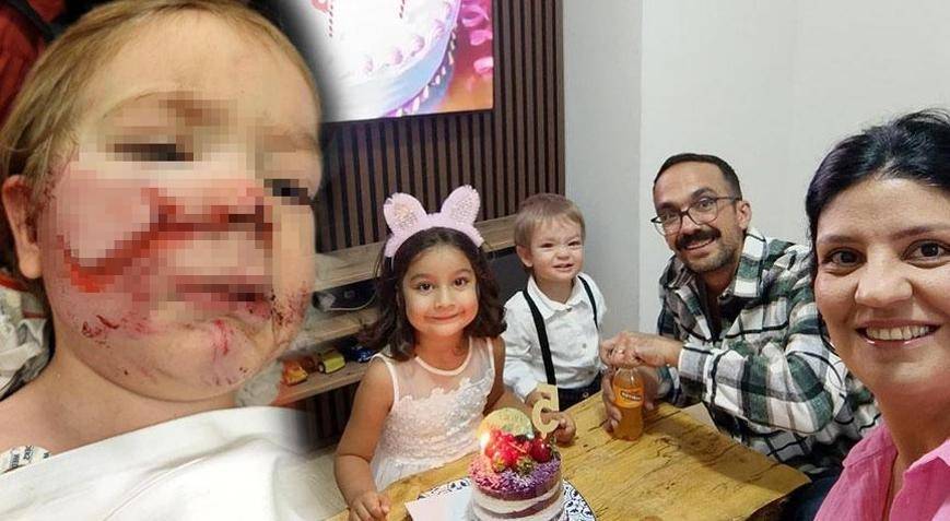 Ankara’da Dehşet: Pitbull 1,5 ve 5 Yaşındaki Kardeşlere Saldırdı! Şikayet Yağmuru ve Şok İddialar!