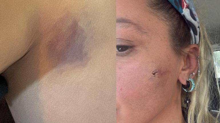 Yıldız Asyalı Eşinden Şiddet Gördüğünü Açıklamıştı:Mustafa Semih Demirci'den Yanıt Gecikmedi!